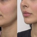 کلینیک زیبایی و بوتاکس گلبهار