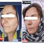 کلینیک زیبایی دکتر فاطمه کوچالی