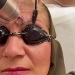 ریموو تتو بنفشه