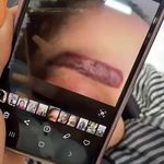 ریموو تتو بنفشه