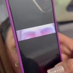 ریموو تتو بنفشه