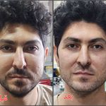 کلینیک زیبایی رز سفید