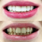 دندانپزشک دینا شعاعی