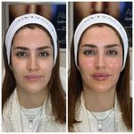 مطب زیبایی دکترمونازرنگ