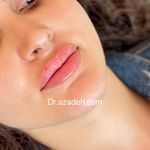 کلینیک زیبایی و لیزر دکتر آزاده اسماعیلی