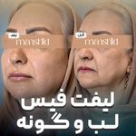 کلینیک زیبایی مانشید