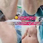 خدمات تخصصی ناخن و پدیکور و درمان ترک پا