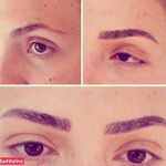 میکروپیگمنتیشن استار