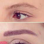 میکروپیگمنتیشن استار