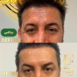 کلینیک زیبایی اریکا(پوست مو لیزر)