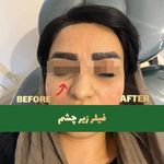 کلینیک زیبایی اریکا(پوست مو لیزر)