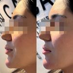 کلینیک زیبایی اریکا(پوست مو لیزر)