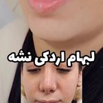 کلینیک زیبایی لیزر لاغری فشیال سان