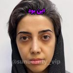 کلینیک زیبایی لیزر لاغری فشیال سان