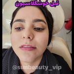 کلینیک زیبایی لیزر لاغری فشیال سان