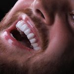 خدمات زیبایی دندانپزشکی نیوفیس