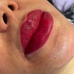 پاکسازی پوست اسکالپ اسکراب سر دکتر احمدی
