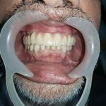 مطب ایمپلنت دکتر نیما شفیعی