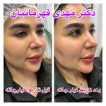 کلینیک زیبایی آفرینش،دکتر مهدی قهرمانیان
