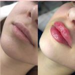 کلینیک پوست و زیبایی ژیلاوَش