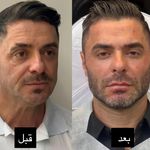 کلینیک پوست وزیبایی ومرکز تخصصی فیلربادی