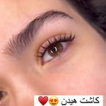 کاشت مژه هیدن ریحانه رجبی