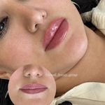مرکز لیزر ،پوست و زیبایی کندی بیوتی