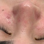 کلینیک فیشال و ماساژ سارن اسکین سارا