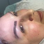 کاشت ابروی هیلدا