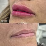 کلینیک لیزر و زیبایی دکتر لیلا حسینی