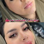 کلینیک زیبایی و لیزر هیرا