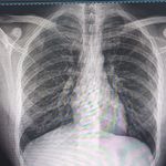 رادیولوژی و سونوگرافی پژواک