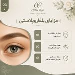 مرکز بلفاروپلاستی فوق تخصصی رز سفید