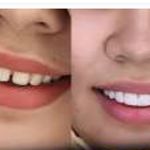 کلینیک دندانپزشکی هیروان