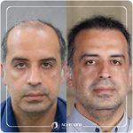 کلینیک پوست مو و زیبایی نوین ایرانا