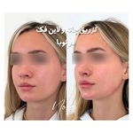 کلینیک زیبایی و لیزر مو زائد نوبا
