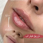 مرکز لیزر ،پوست و زیبایی کندی بیوتی
