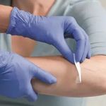 کلینیک تخصصی درمان زخم