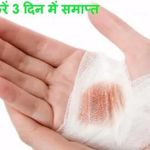 کلینیک تخصصی درمان زخم