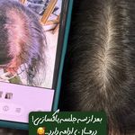 خانه رونوفل