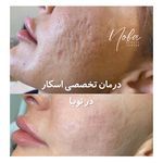 کلینیک زیبایی و لیزر مو زائد نوبا