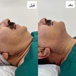 کلینیک لیزر پوست مو زیبایی الیزا شهرری
