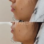 كلينيك زيبایی و ليزر دكتر اميررضا طاهری