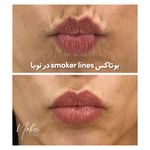 کلینیک زیبایی و لیزر مو زائد نوبا