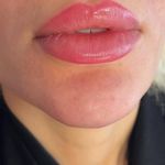 مطب زیبایی دکترمونازرنگ