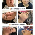 مرکزپوست،زیبایی وتناسب اندام ساراخداکرمی