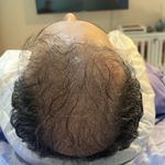 اولین مرکز میکرواسکالپ مشهد تاپ اسکالپ