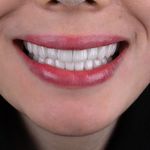 دندانپزشکی دکتر قاسم نژاد *بیمه نداریم*