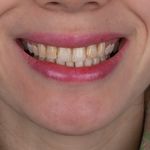 دندانپزشکی دکتر قاسم نژاد *بیمه نداریم*