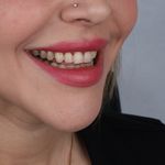 دندانپزشکی دکتر قاسم نژاد *بیمه نداریم*